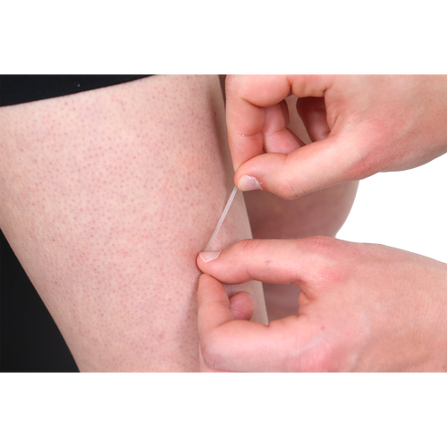 Wound closure strip - 3mm x 75mm (pack of 5)